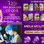 Giải pháp cải thiện nám – tàn nhang an toàn, hiệu quả tại Thẩm mỹ viện Bena USA