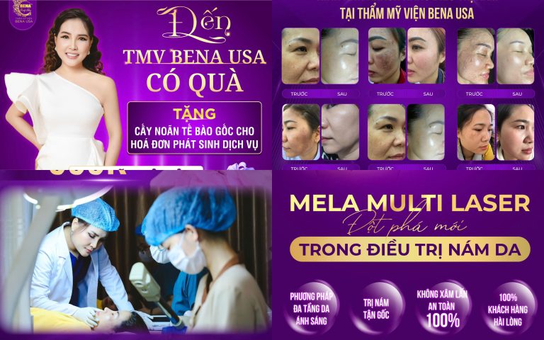 Thiết kế chưa có tên