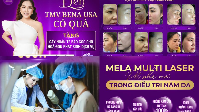 Giải pháp cải thiện nám – tàn nhang an toàn, hiệu quả tại Thẩm mỹ viện Bena USA